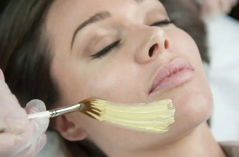 Close-up of woman lying down with eyes closed as gloved hand applies yellow cream mask to her cheek with brush in clinic