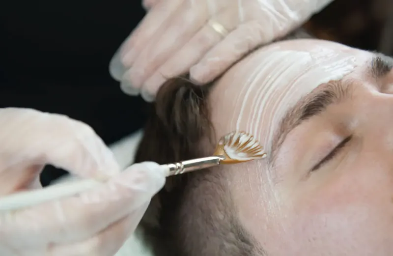 Gloved hands applying white cream to man's forehead with brush in aesthetic clinic treatment