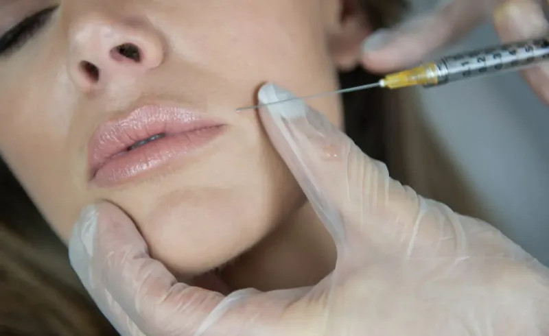 Close-up of clinician in gloves injecting lip filler into woman's lips during aesthetic procedure