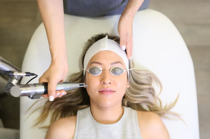 Woman lying on treatment bed with headband and goggles as technician applies laser device to her face
